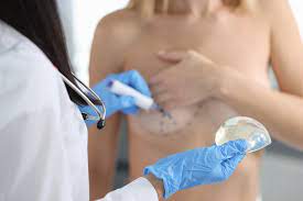 How To Perform A Breast Augmentation: Step-By-Step Guide